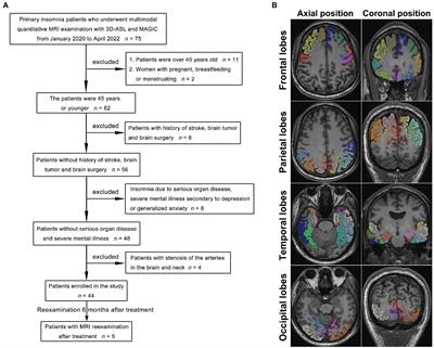 Quantitative association of cerebral blood flow, relaxation times and proton density in young and middle-aged primary insomnia patients: A prospective study using three-dimensional arterial spin labeling and synthetic magnetic resonance imaging